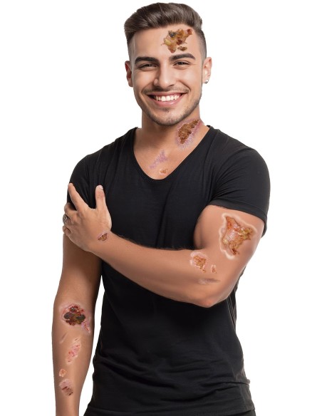 Tatouages fausses plaies infectées