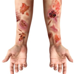 Tatouages fausses plaies infectées 2