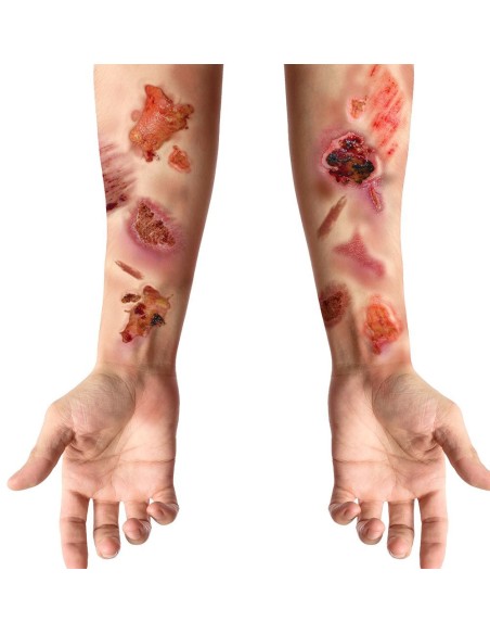 Tatouages fausses plaies infectées