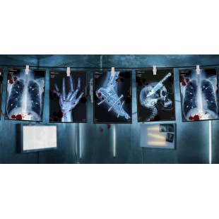 Guirlande radiographies humaines