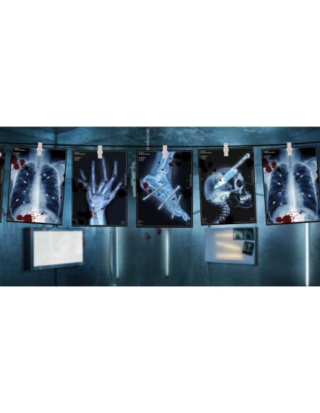 Guirlande radiographies humaines